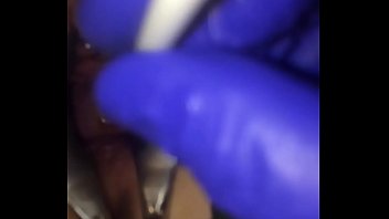 catheter gyno