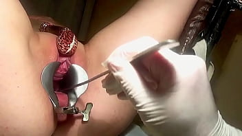 gyno teen cervix