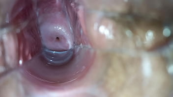 speculum cervix teen porn